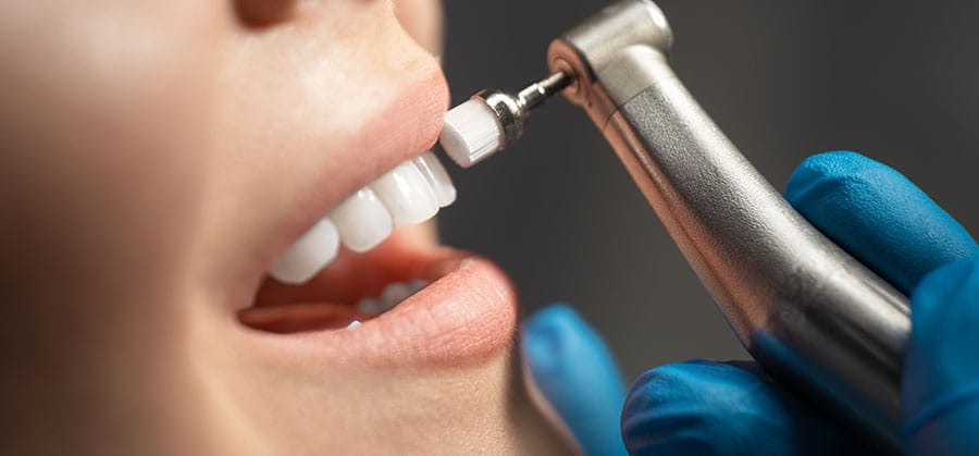 Dental Implant